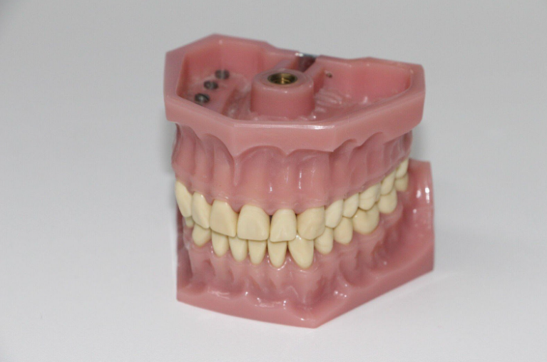 Why a Wax Try in Is Essential for Successful Dental Restorations